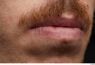 HD Face Skin John Hopkins face lips mouth skin pores…